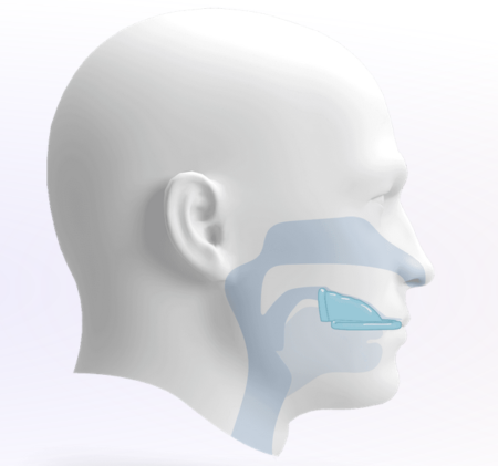 Profil eines männlichen Kopfs mit einem Gaumentrainer